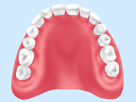 レジン床義歯（保険適用内）