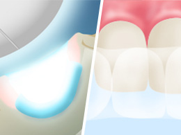 デュアルホワイトニング